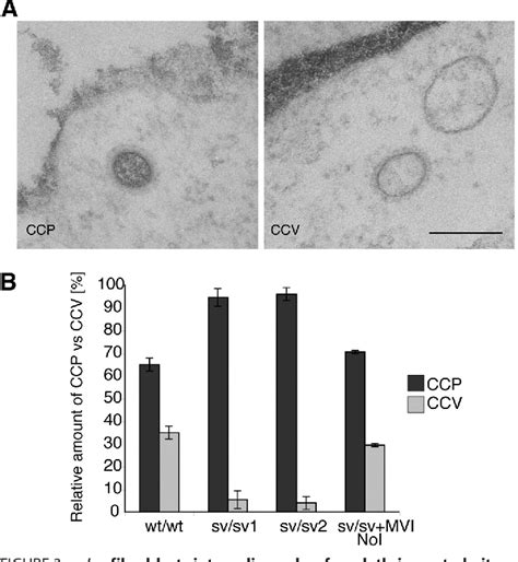 Figure 1 From Loss Of Myosin VI No Insert Isoform NoI Induces A