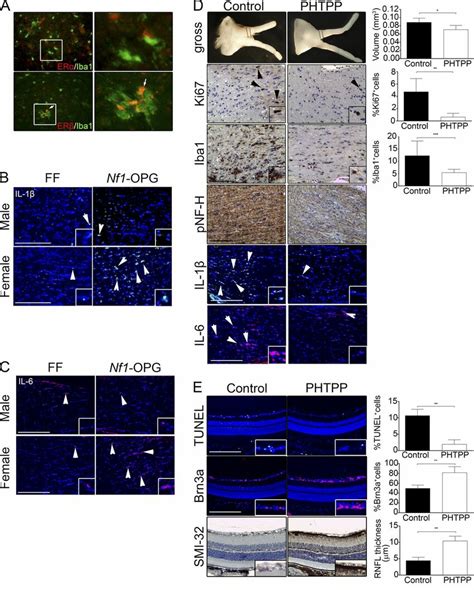 Estrogen Acts Through Er To Activate Optic Nerve Microglia In Female