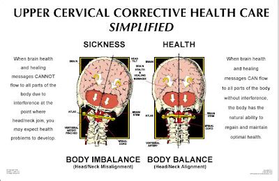 upper cervical blog  history  upper cervical illustrations