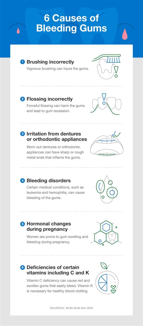 Bleeding Gums: Causes, Treatment, and Prevention - SmartMouth