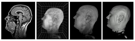 Volume Rendering Bioimage Analysis Training Resources