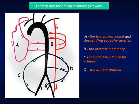 Figure 4 From Coarctation Of The Aorta Usefulness Of Mr And Mdct Aortography Semantic Scholar