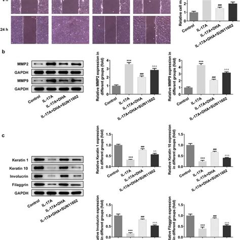 Dha Inhibits Migration And Induces Cell Differentiation In