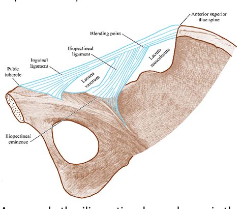 [PDF] ILIOPECTINEAL LIGAMENT AS AN IMPORTANT LANDMARK IN ILIOINGUINAL ...