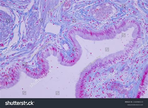 Columnar Epithelium Human Gall Bladder Under Stock Photo 2160980133