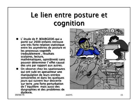 SDP Troubles Neurovisuels Et Dys Apesanteur Cerveau Et Proprioception