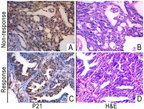 Representative Immunohistochemical Staining For P21 And Hande Analysis Of