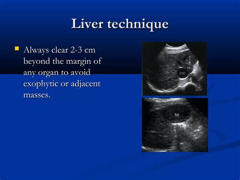 Liver ultrasound | PPT