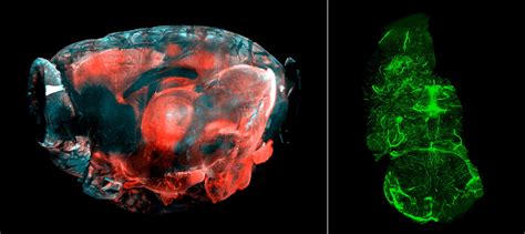 Tissue Clearing Light Sheet Microscopy And Deconvolution And Image