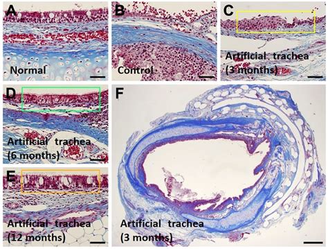 Histopathologic Images Of Epithelial Regeneration Compared With The