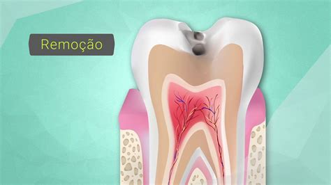 Odontologia Pr Cl Nica Em Oclus O E Dent Stica Youtube