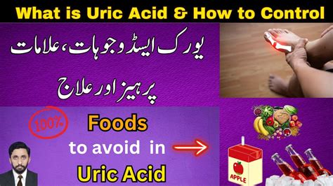 What Is Uric Acid Hindiurdu How To Reduce Uric Acid Level By Foods