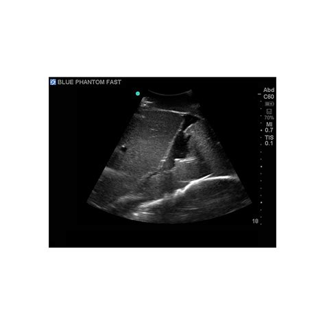 FAST Exam Ultrasound Training Model