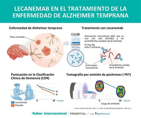 Lecanemab Y Donanemab Avances Prometedores En El Tratamiento Del Alzheimer