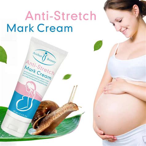 Natural Aichun Beauty Anti Stretch Marks Cream Stretch Marks Repair