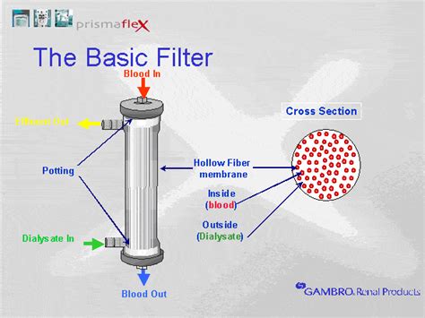 crrt haemodialysis filter litfl ccc equipment