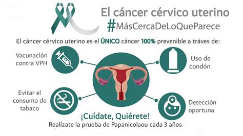 Curable 90 Por Ciento De Los Casos De Cáncer Cervicouterino Detectado A Tiempo Unam Global