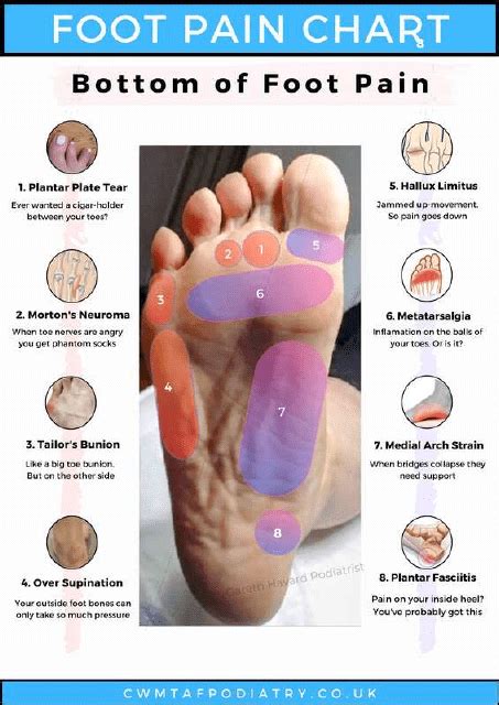 Foot Pain Chart - Bottom of Foot Pain Download Printable PDF ...