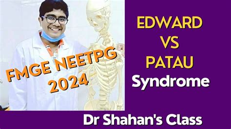 Edward Vs Patau Syndrome Fmge Neetpg Youtube