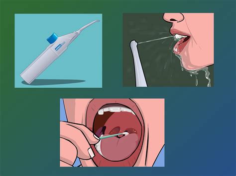 How+to+Remove+Tonsil+Stones+(Tonsiliths)+--+via+wikiHow.com Vegan ...