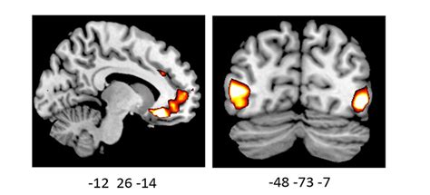 How Your Brain Reacts To Emotional Information Is Influenced By Your Genes