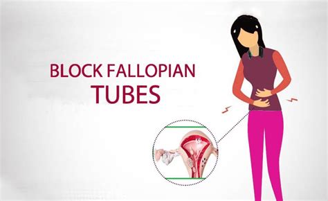 Fallopian Tube Blockage Ke Karan Lakshan Janch Aur Upchar In Hindi