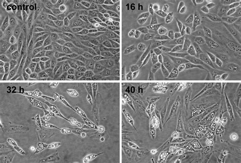 Cho Cell Culture Contamination | Hot Sex Picture