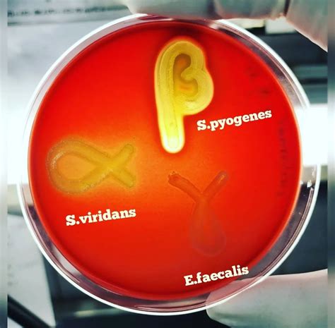 Hem Lisis Alfa En Agar Sangre