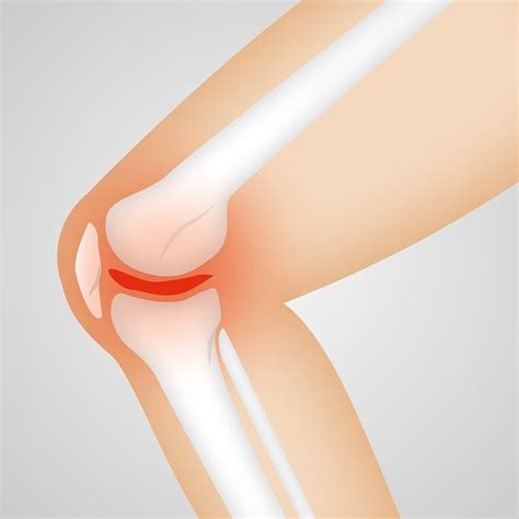 Knie Stabilisieren Wissen Bungen Deineigeneshomegym De