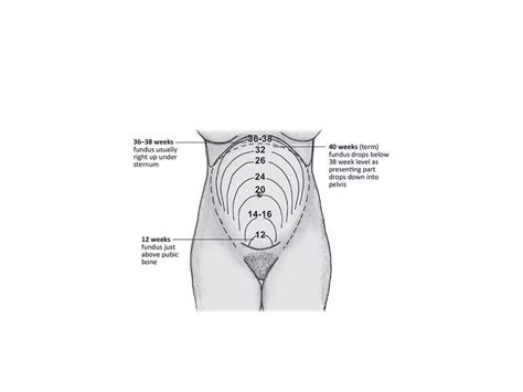 Measuring Of Fundal Heightpptx