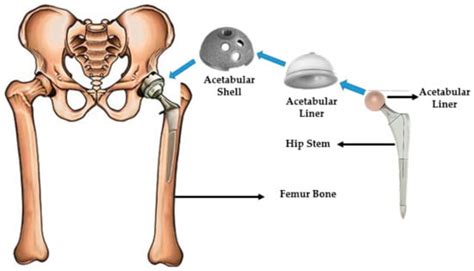 Polymers Free Full Text A Review Of Biomaterials And Associated