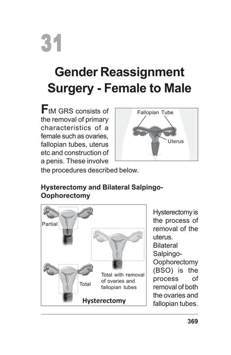 Gender Reassignment Surgery Female To Male Dr Piyush Saxena