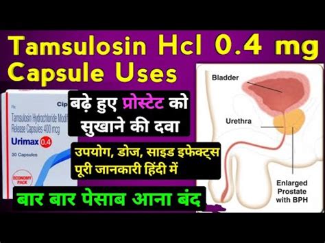 Tamsulosin Hcl 0 4 Mg Capsule Uses In Hindi Urimax 0 4 Kis Kaam Aati