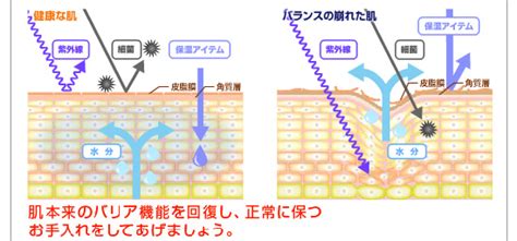 Aposty｜アポスティー 肌トラブルに製薬会社のアプローチ