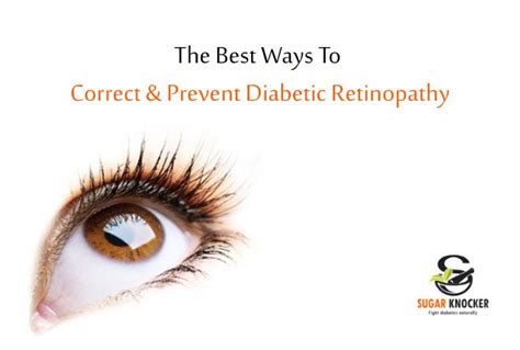 Diabetic Retinopathy Ways To Correct And Prevention