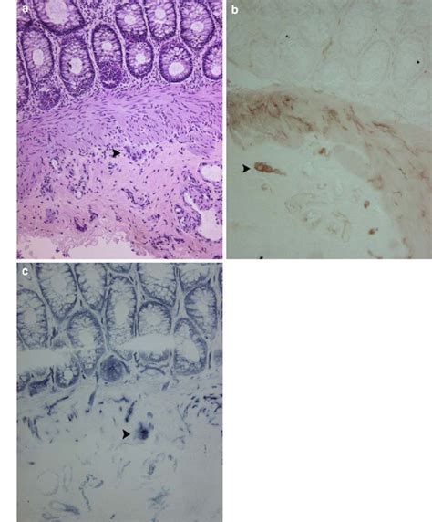 Normal Rectal Suction Biopsy Specimen Including Mucosa Muscularis Download Scientific Diagram