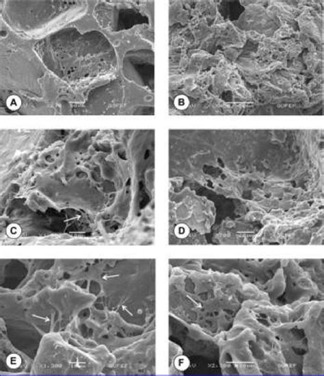 Representative Sem Images Demonstrating The Macroporous Plga Scaffold Download Scientific