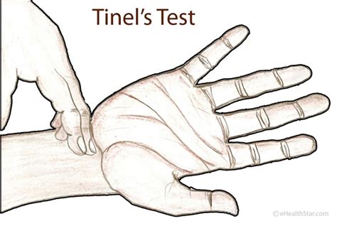 Wrist And Hand Provocative Testing Osteopathy Revision Notes