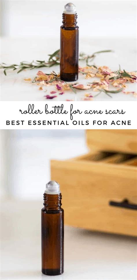 Essential Oils for Acne Scars - Our Oily House