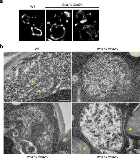 Dma1 And Dma2 Are Required For The Maintenance Of Mitochondria