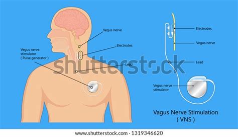 Stimulate Vagus Nerve Images Stock Photos D Objects Vectors