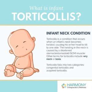 Infant Torticollis And How Chiropractic Can Help Kelowna Chiropractic