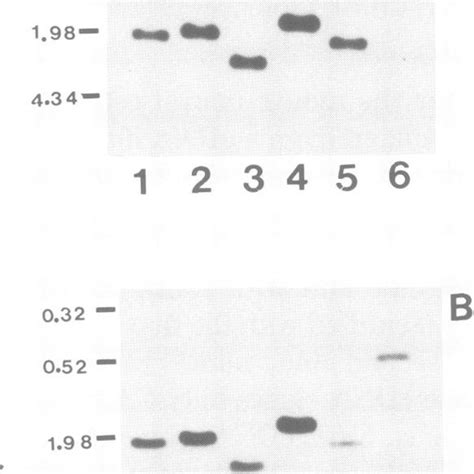 Blot Hybridization Of The Nick Translated Inserts From PMl 3 A And