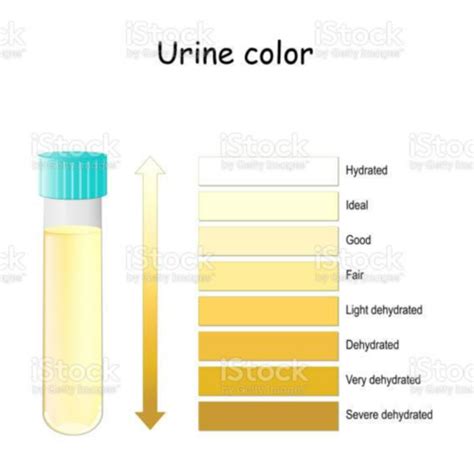 Urinalysis Flashcards Quizlet