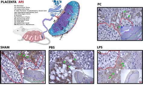 Evaluation Of Changes Of Apelin And Apelin Receptor APJ Expression In