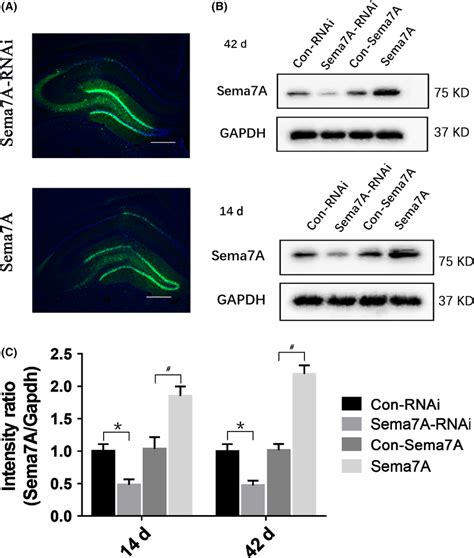 Expression Of Sema7a And Distribution Of Egfp In The Hippocampus After