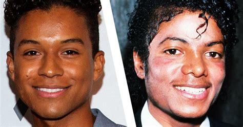 Michael Jackson Plastic Surgery Progression - Plastic Industry In The World