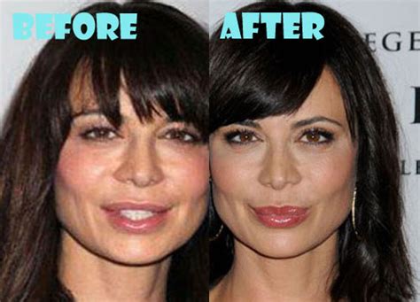 Catherine Bell Plastic Surgery Before and After - Lovely Surgery