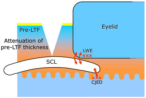 Life Free Full Text Dynamic Aspects Of Pre Soft Contact Lens Tear