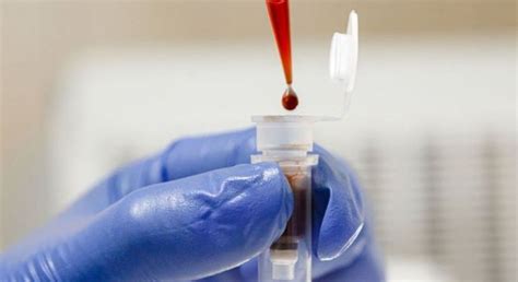 Novo exame de sangue detectar câncer de cólon en estágio inicial